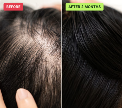 HaloGrow Hair Spray Benefites