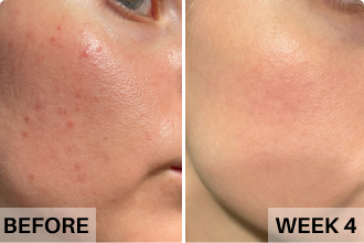 BeautyStat Daily Radiance Skin Refiner Benefits