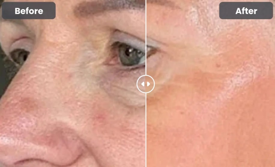 Glokore Bio Collagen Mask-Result