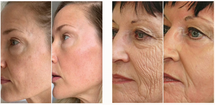 GloraMD Face Lift Serum Benefites