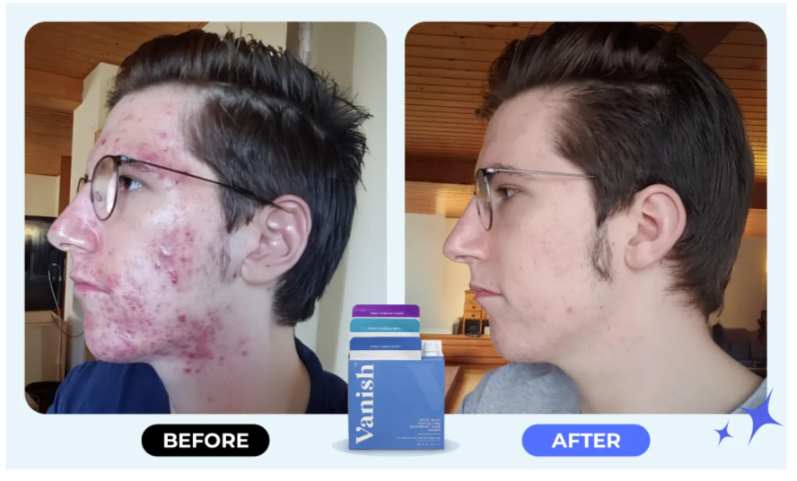 Vanish Dry Serum Customer Reviews